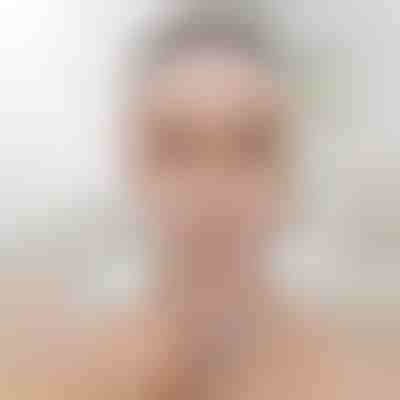 Fascia lifting per scolpire il viso | KIMLIFT